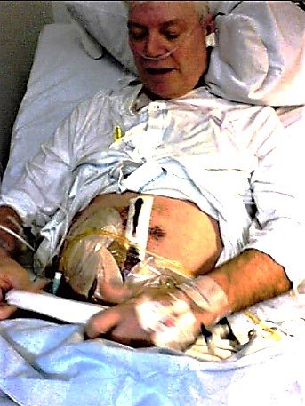2008: Björn opereras för tarmcancer